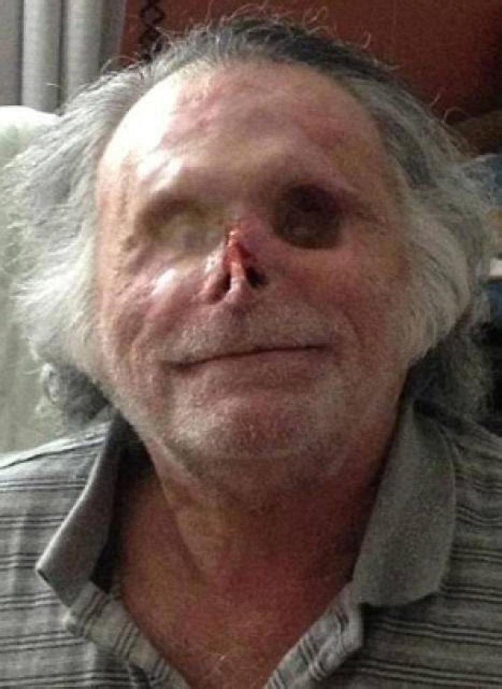 Unraveling The Life Of Ronald Poppo: A Journey Through Resilience